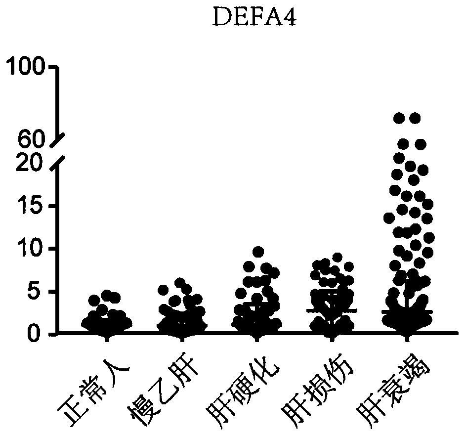 New application of DEFA4 for diagnosis of hepatic failure, kit, and application of kit for diagnosis of hepatic failure