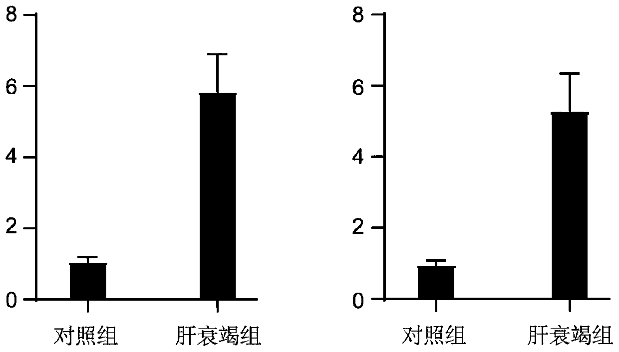 New application of DEFA4 for diagnosis of hepatic failure, kit, and application of kit for diagnosis of hepatic failure