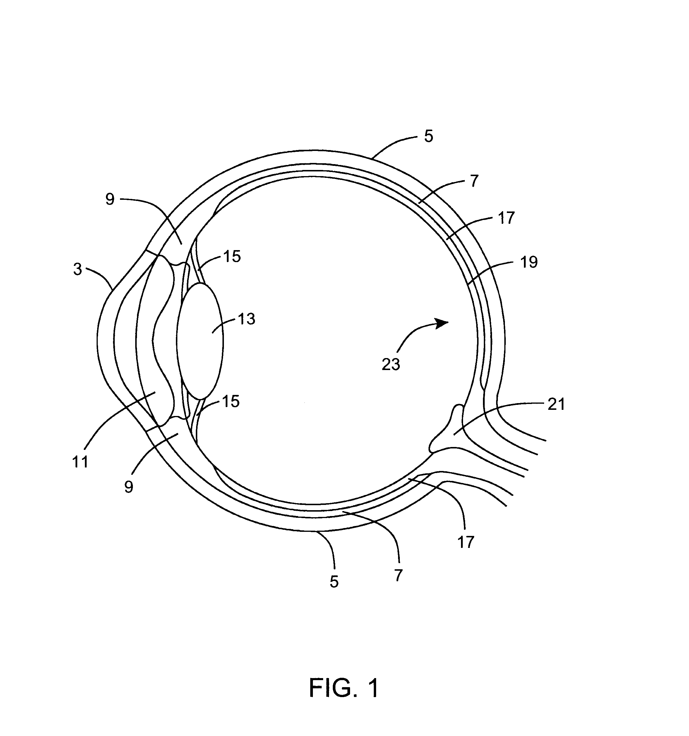 Ophthalmic instrument having an integral wavefront sensor and display device that displays a graphical representation of high order aberrations of the human eye measured by the wavefront sensor