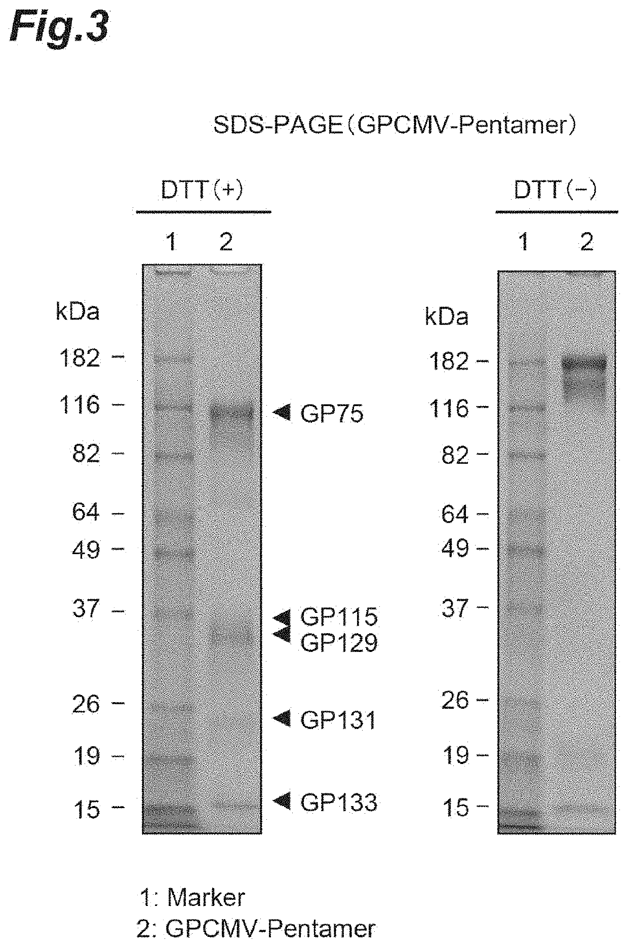 Vaccine for preventing or treating congenital infection with cytomegalovirus