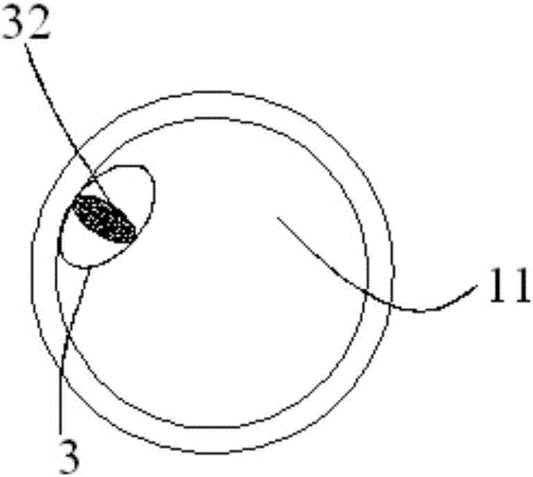 Novel anal canal aerofluxus and defecation device