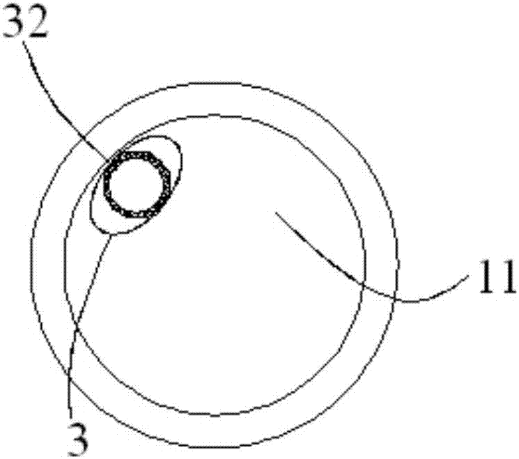 Novel anal canal aerofluxus and defecation device