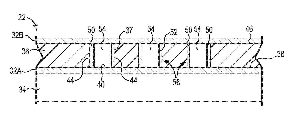 Hybrid printed circuit assembly with low density main core and embedded high density circuit regions