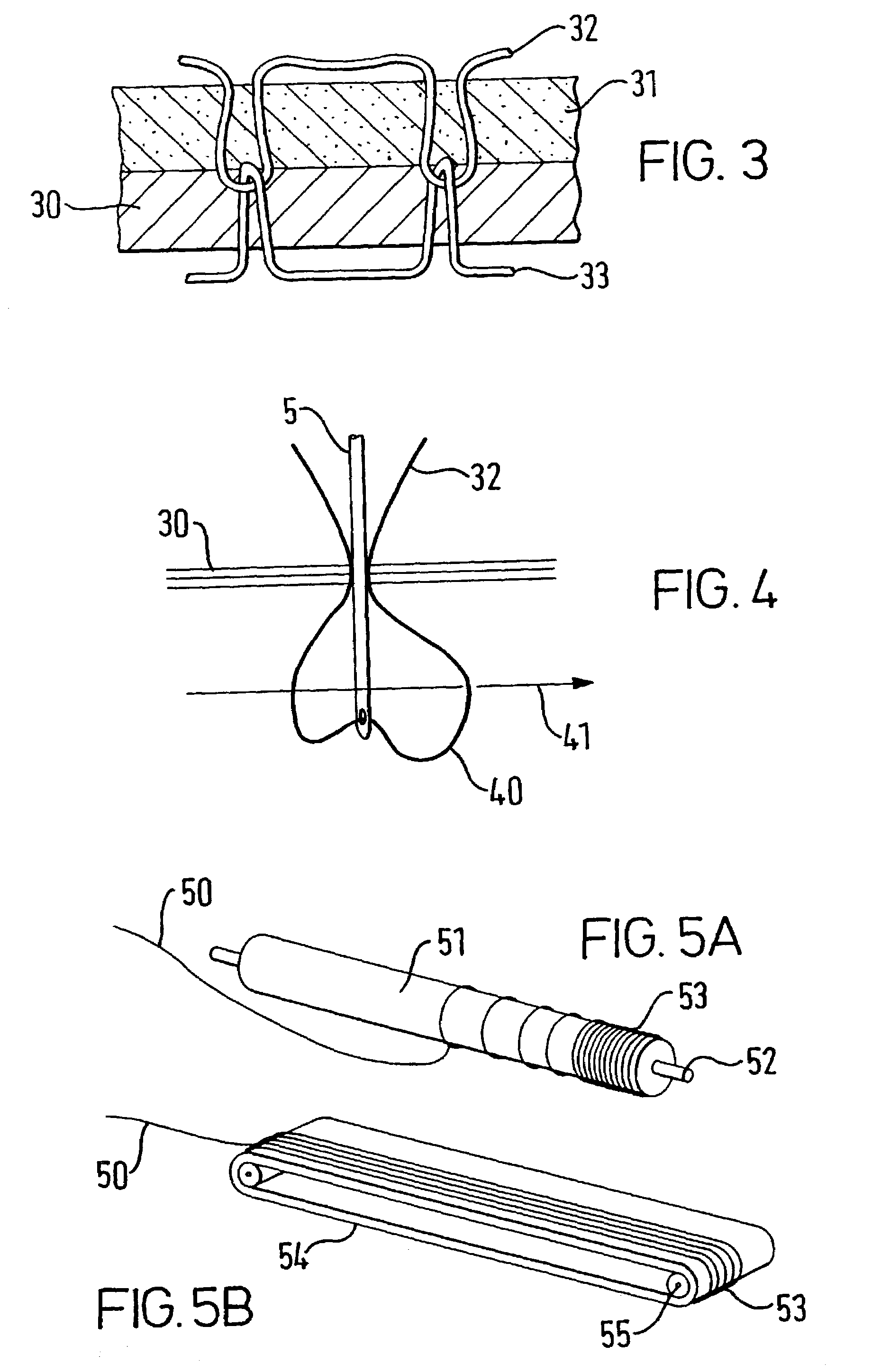 Method for manufacturing a medical implant
