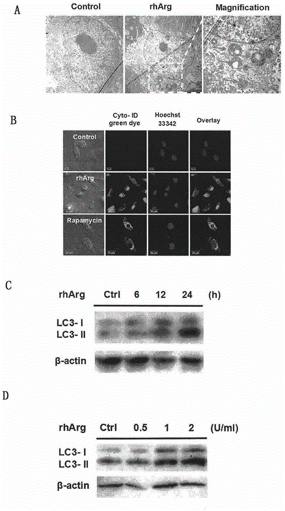 Synergistic drug compound for treating tumor and preparation method thereof