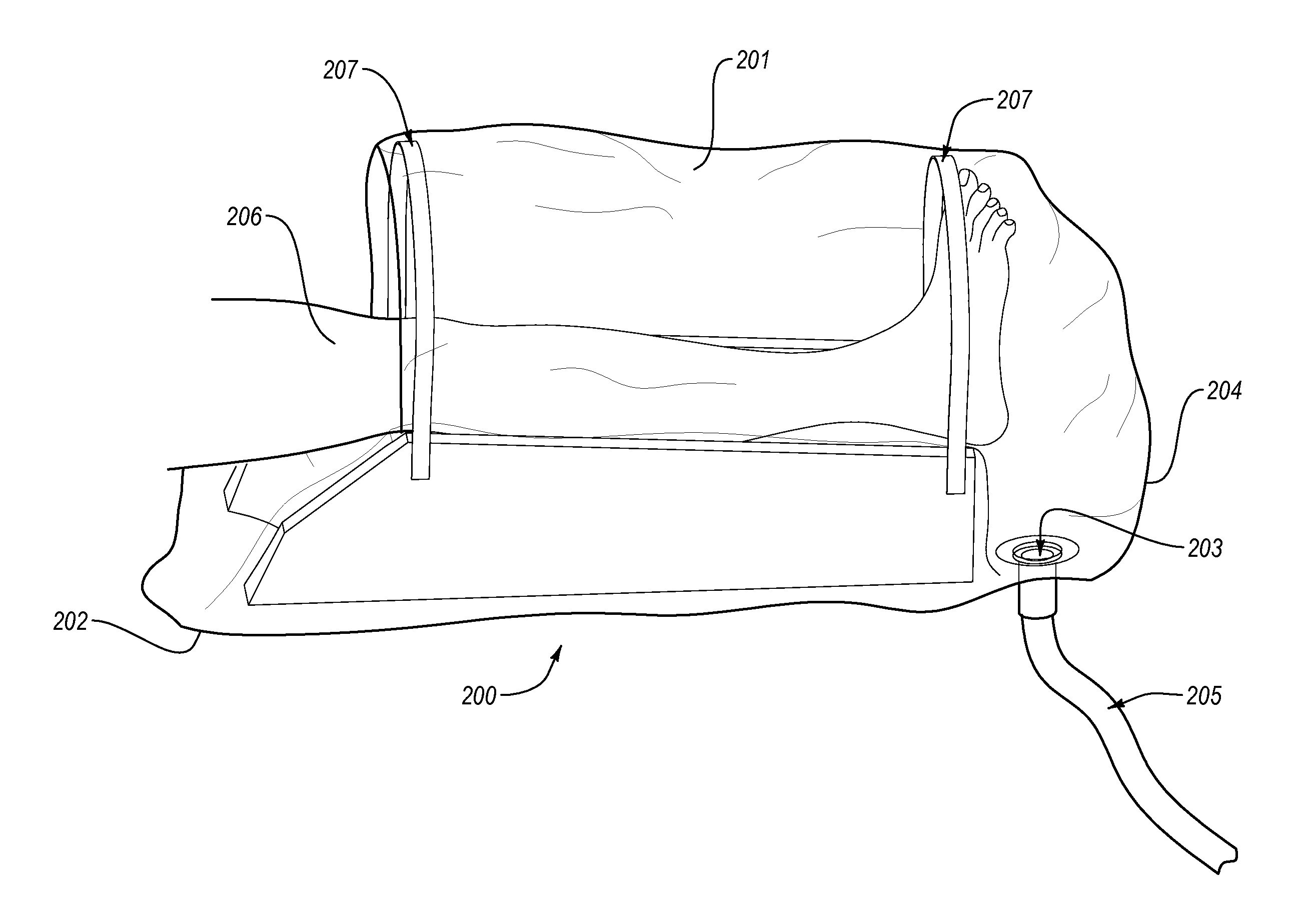 Medical irrigation device and method