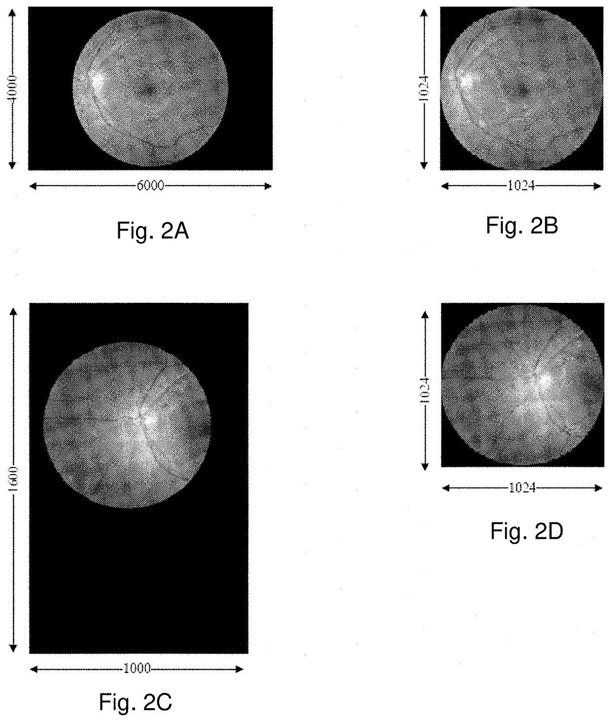 System and method for automated funduscopic image analysis