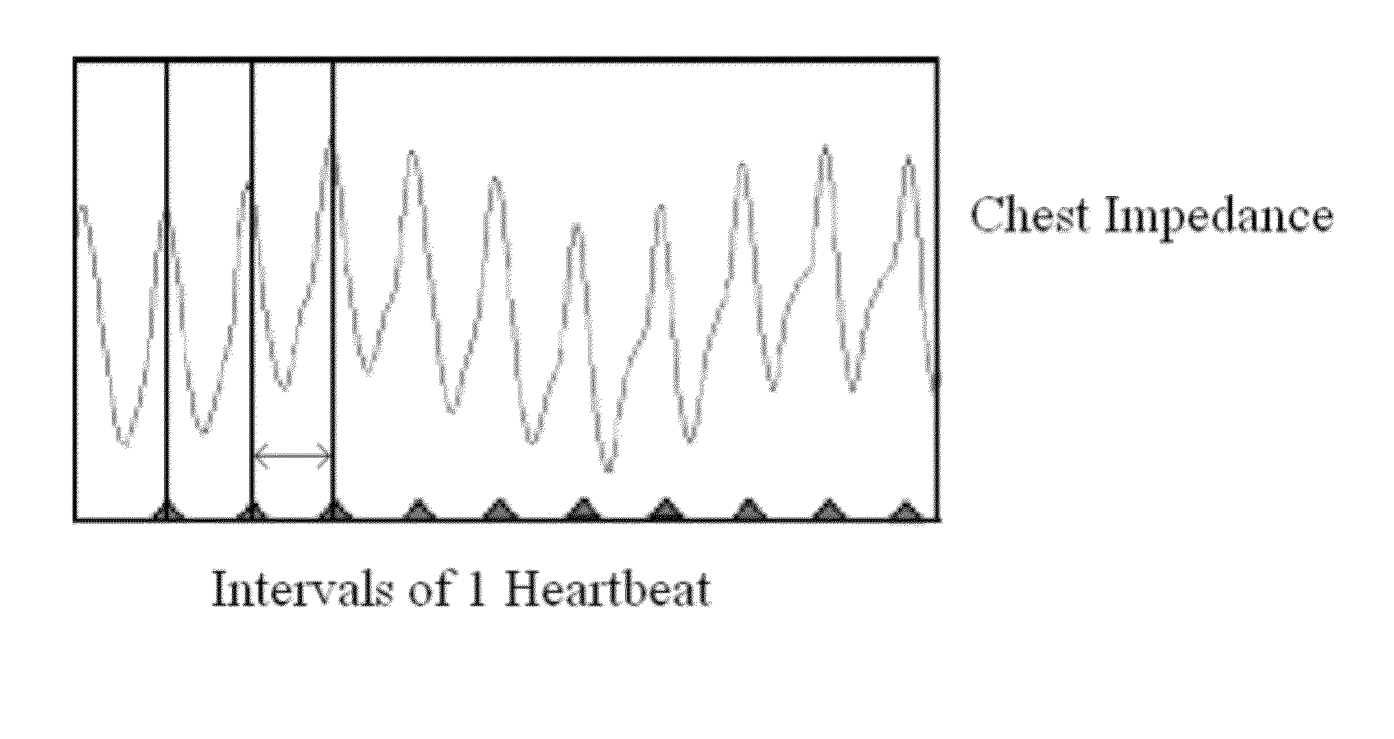 Method and system for detecting apnea