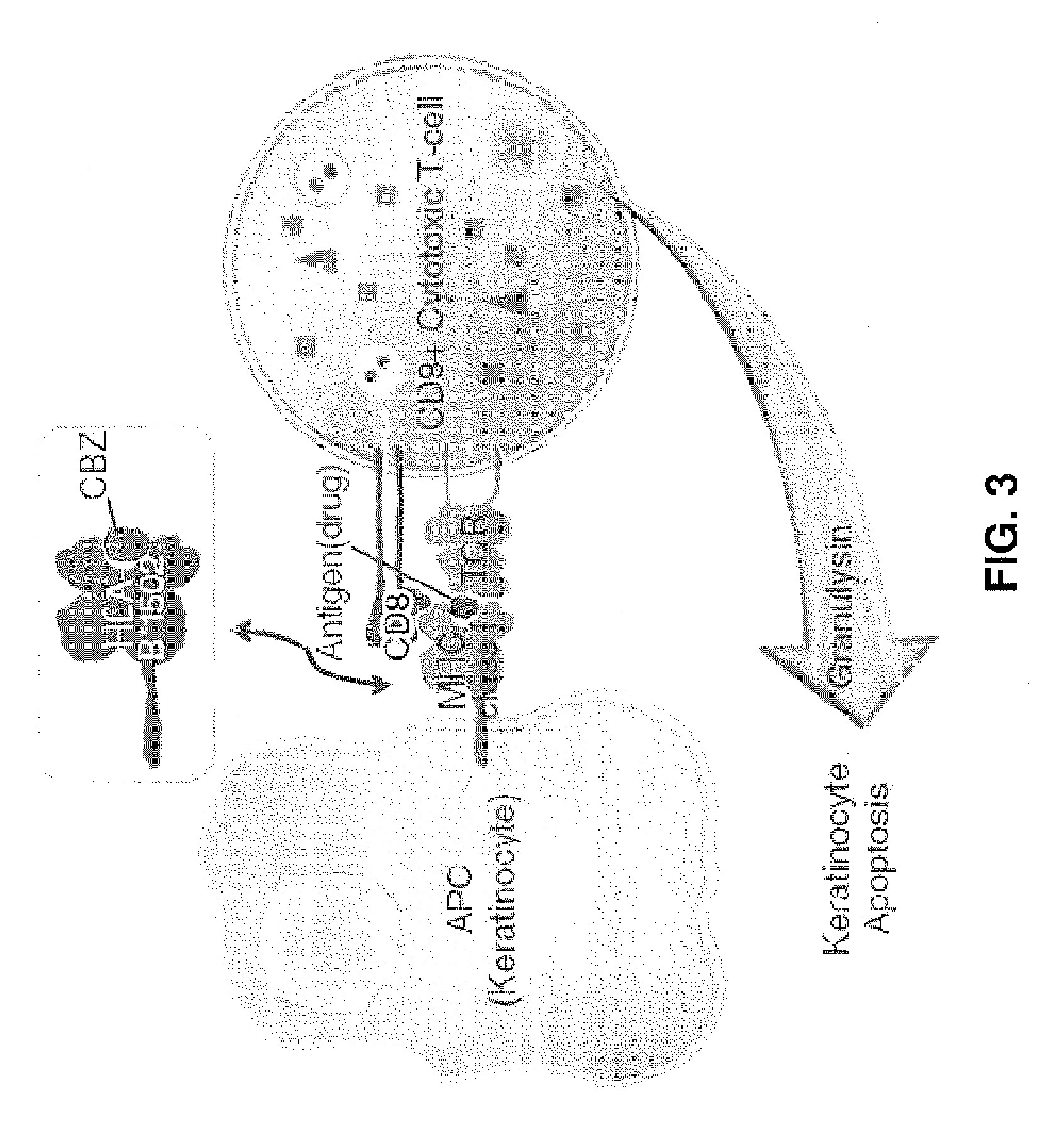 Anti-granulysin antibodies and methods of use thereof