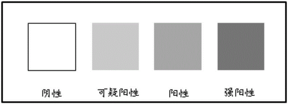 Union application of ferroprotoporphyrin and beta-glucuronidase in prostatic cell heterogeneity hyperplasia detection and kit