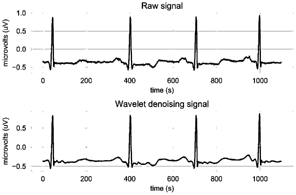 Electrocardiogram classification method and device based on wavelet transform and DCNN (Deep Convolutional Neural Networks)