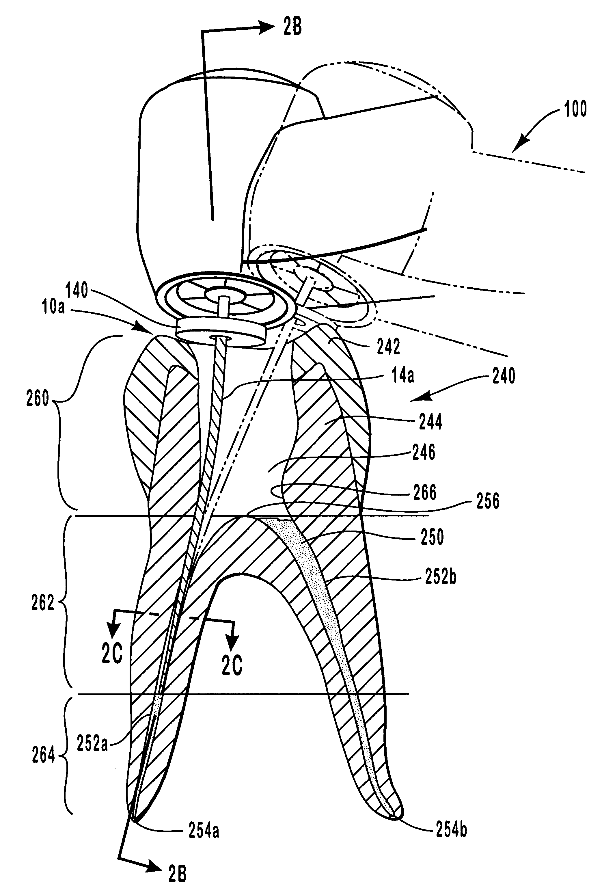 Endodontic systems and methods for preparing upper portions of root canals with increasingly rigid files