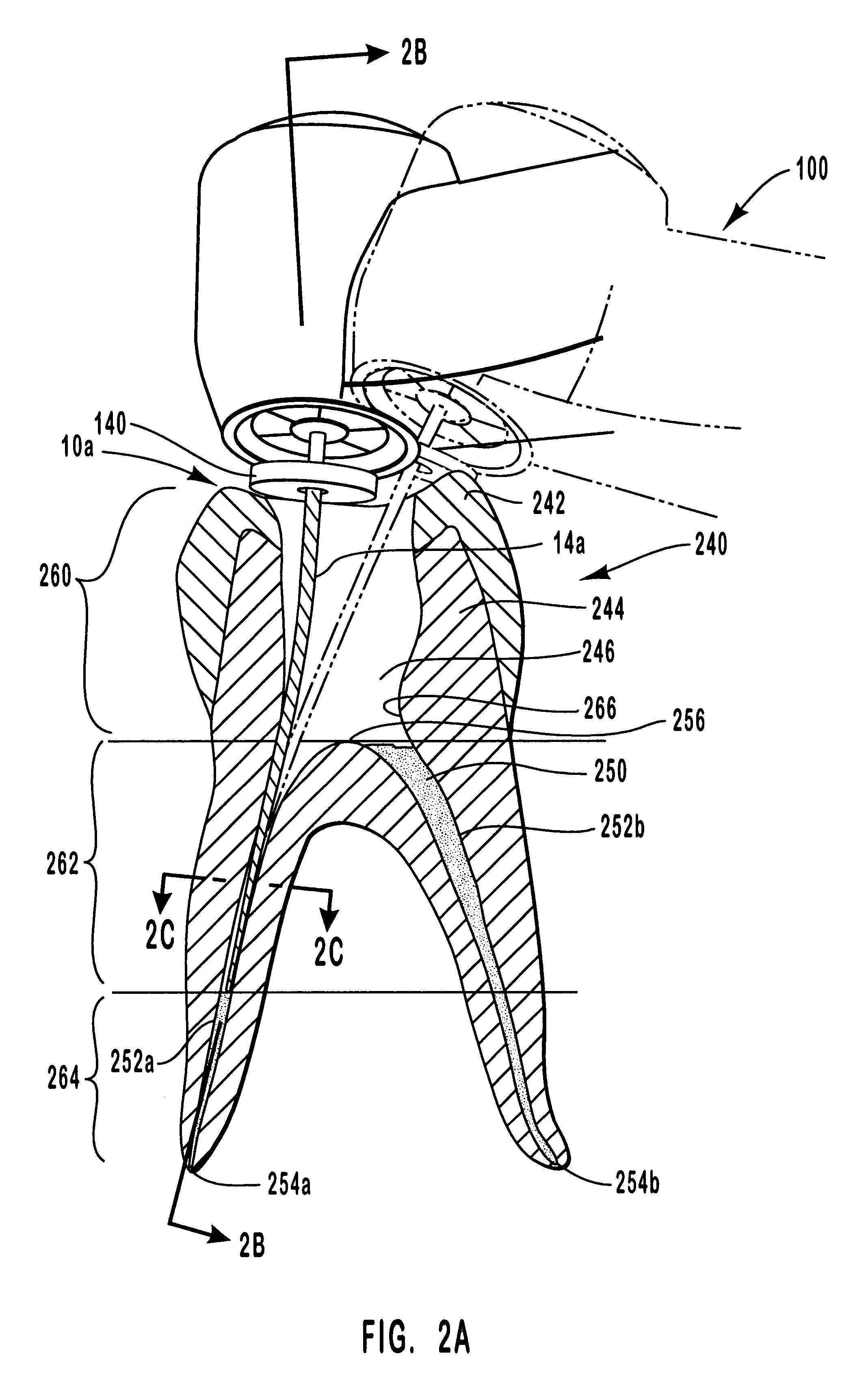 Endodontic systems and methods for preparing upper portions of root canals with increasingly rigid files