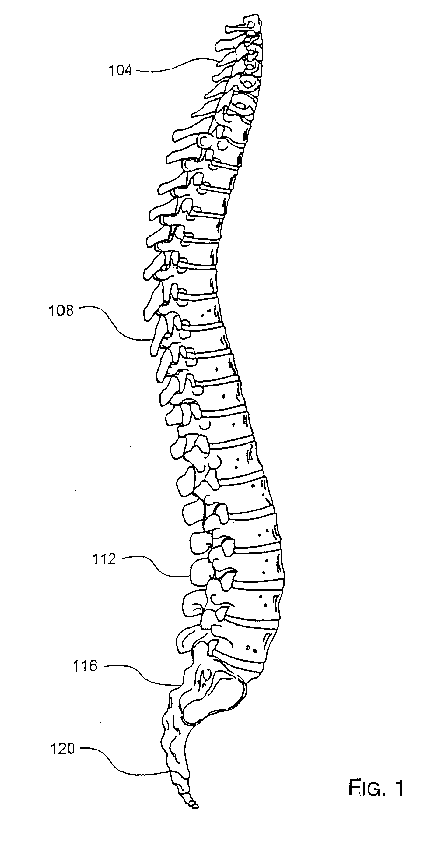 Methods and tools for delivery of spinal motion preservation assemblies