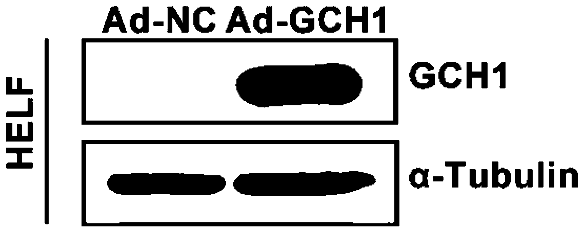 Application of guanosine triphosphate cyclohydrolase 1 and drug