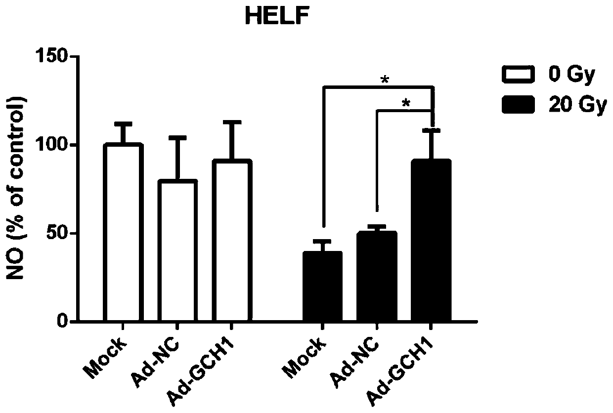 Application of guanosine triphosphate cyclohydrolase 1 and drug