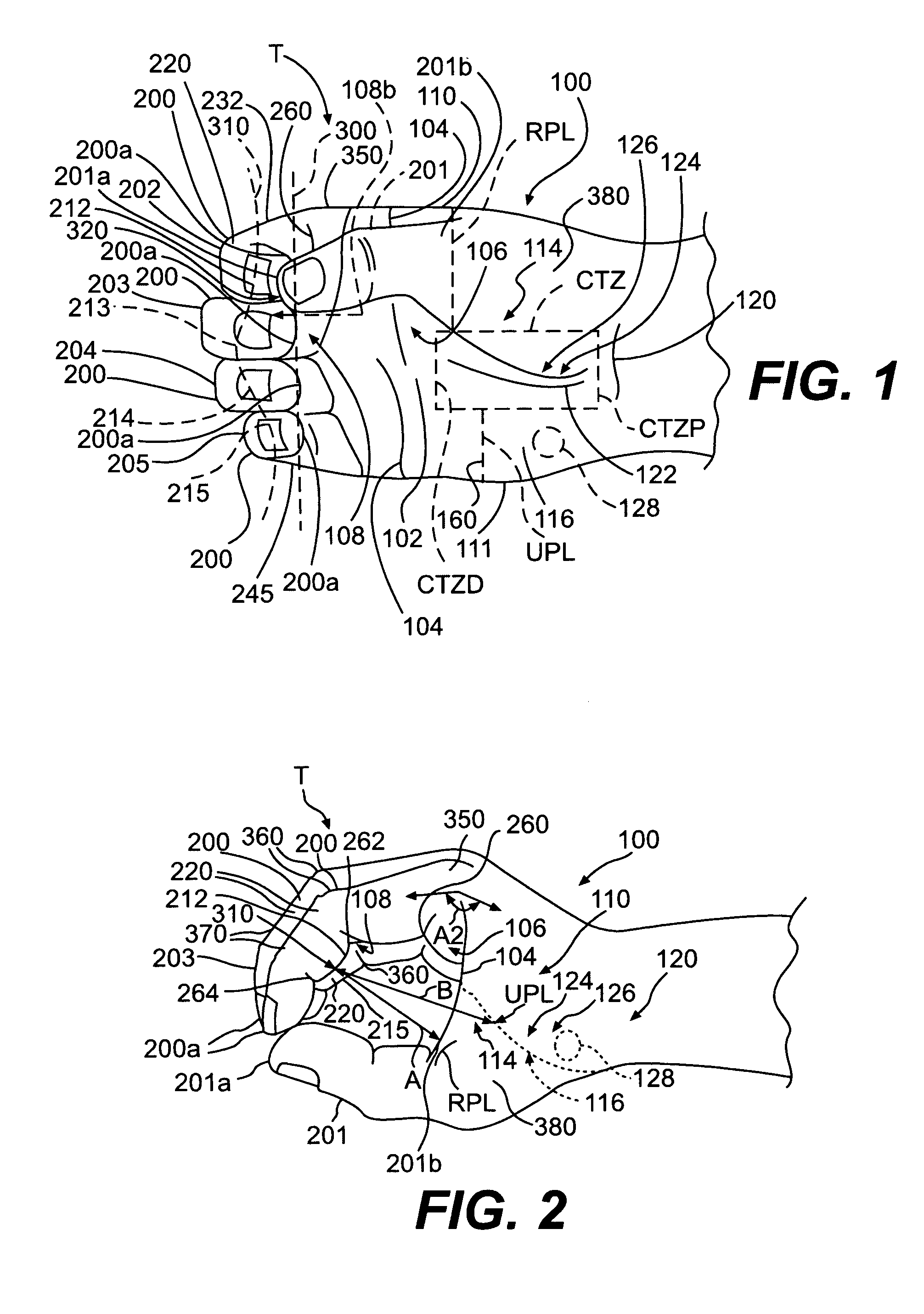 Parallel handle system and method for designing a parallel handle system
