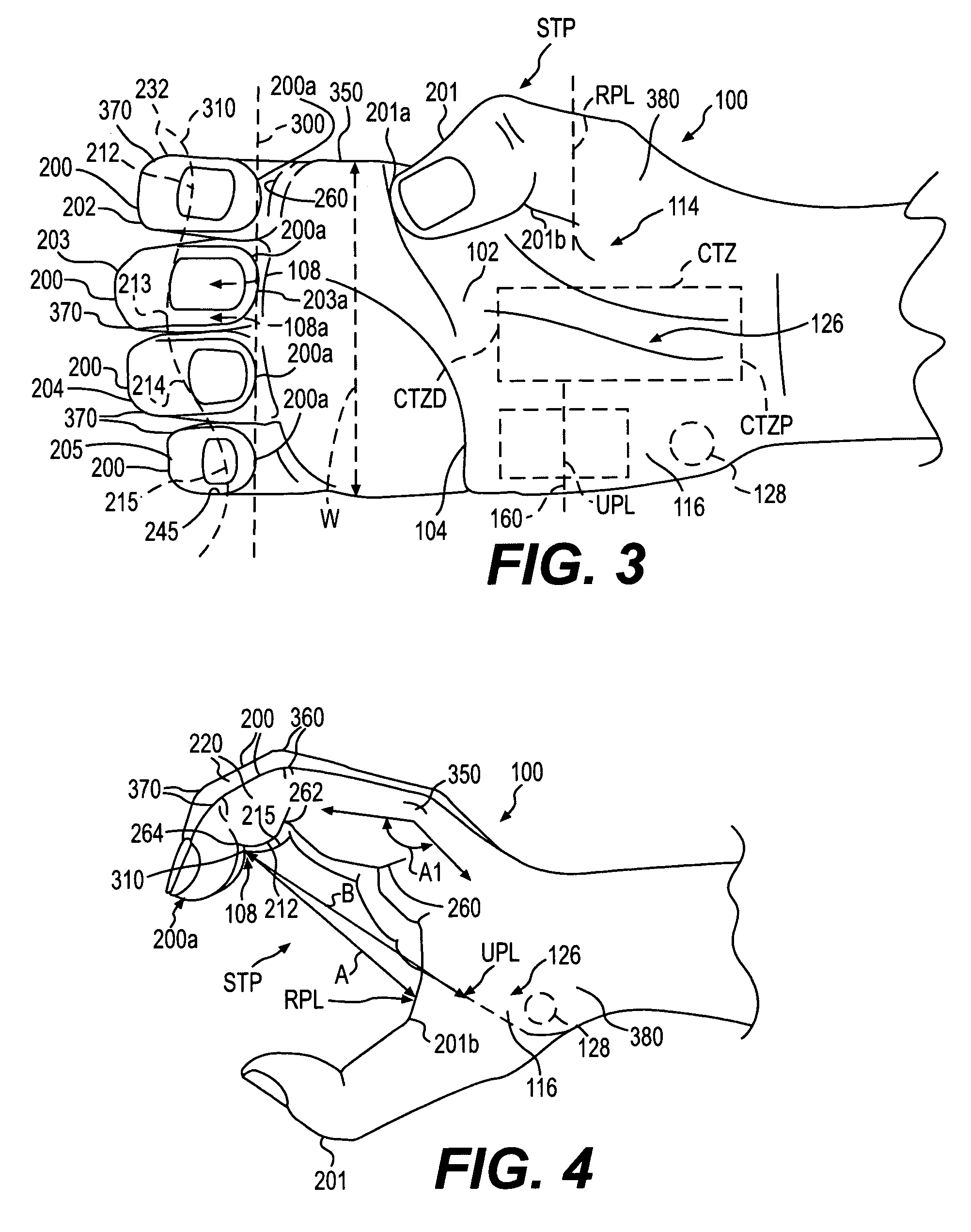 Parallel handle system and method for designing a parallel handle system
