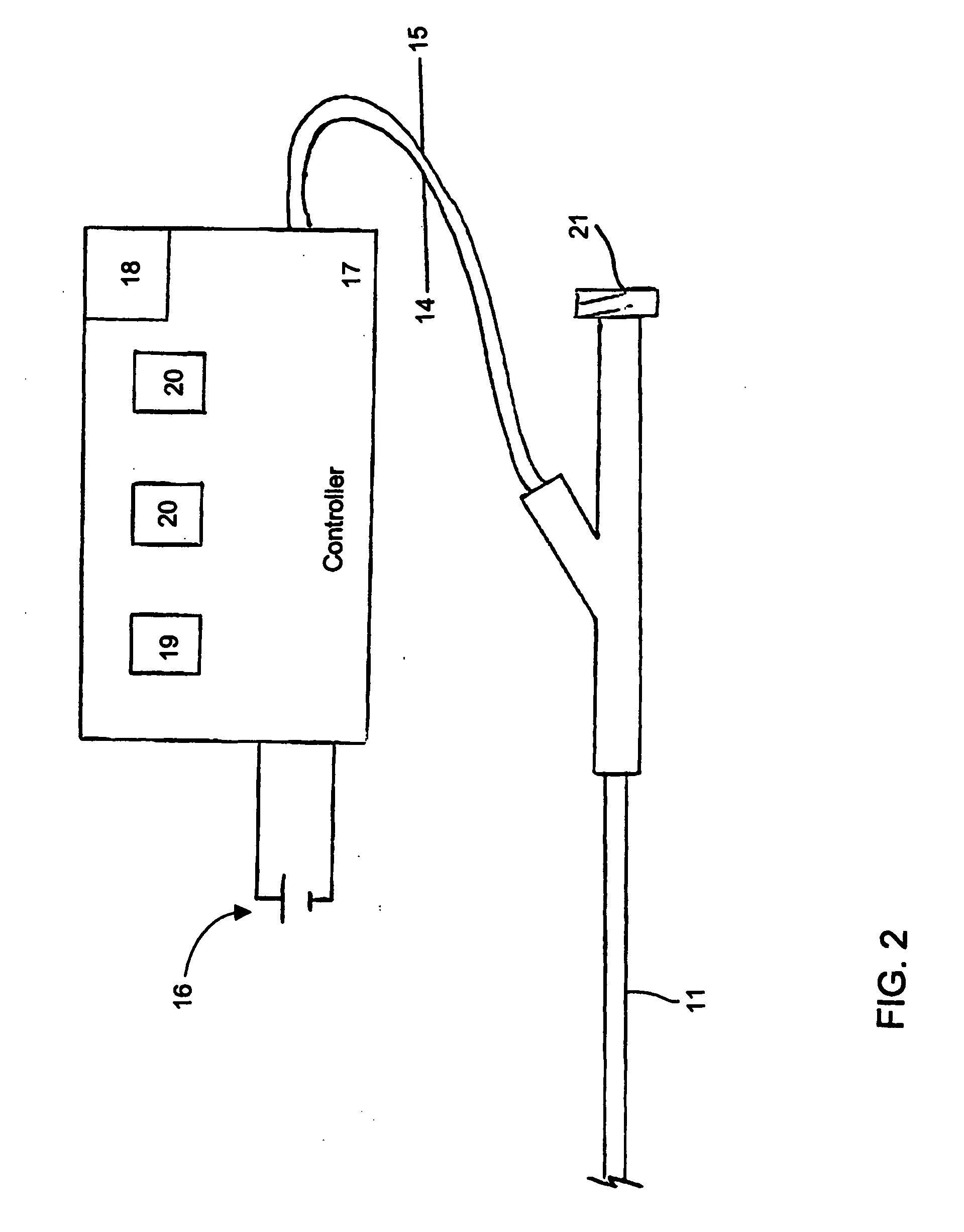 Catheter with controllable stiffness and method for operating a selective stiffening catheter