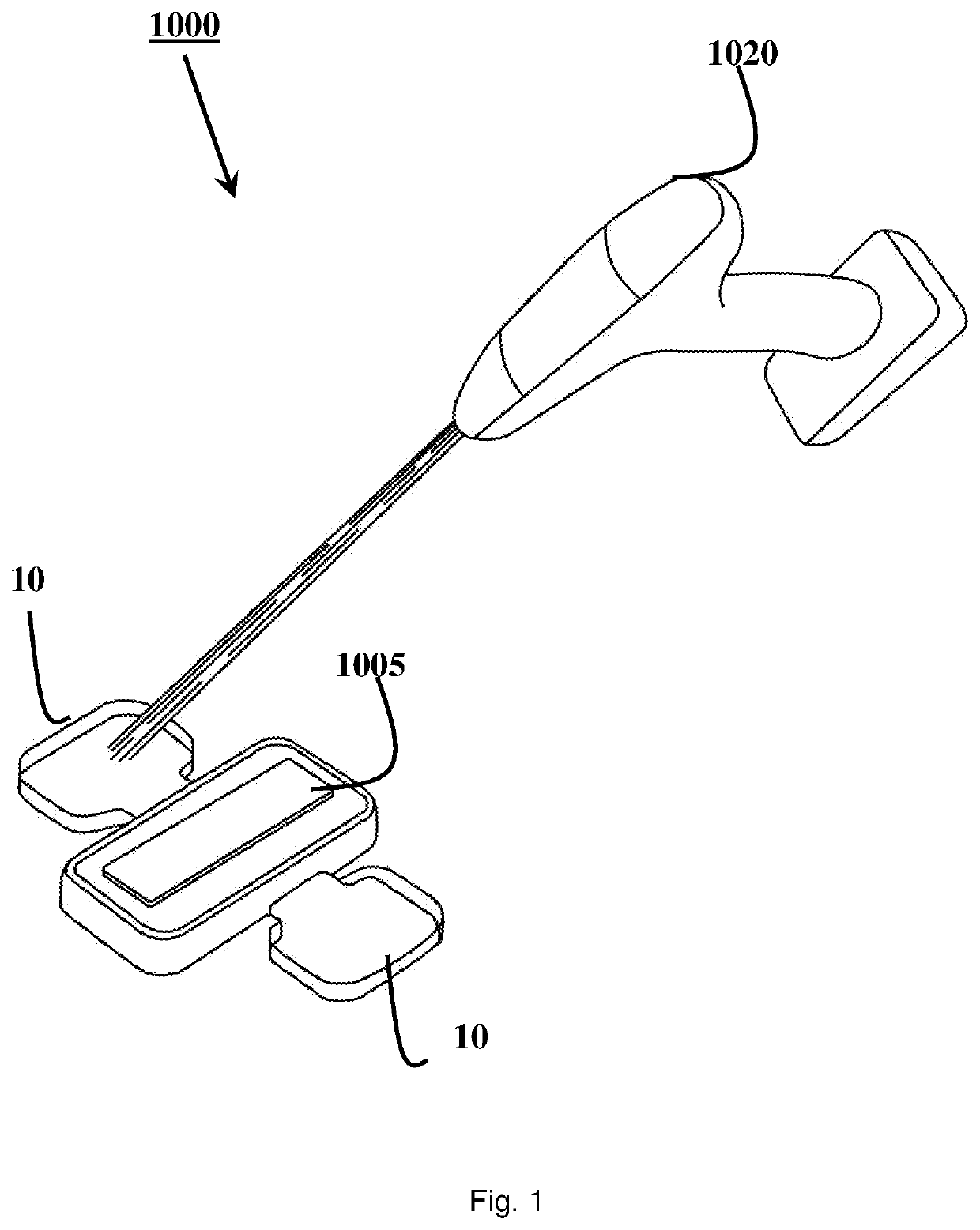 An attachment means for attaching a medical device to tissue, a system for attaching a medical device to tissue, a medical device having an attachment means, a method of attaching a medical device to tissue, and a method of manufacturing an attachment means