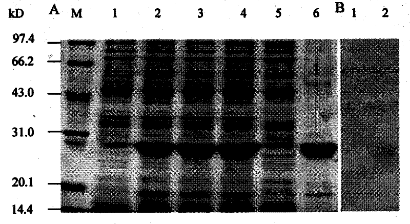 Human Fc&lt;gamma&gt;R II linear ligand binding epitope