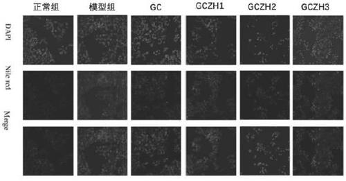 Applications of 3'-geranylchalconaringenin and composition in preparation of products for treating fatty liver