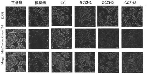 Applications of 3'-geranylchalconaringenin and composition in preparation of products for treating fatty liver