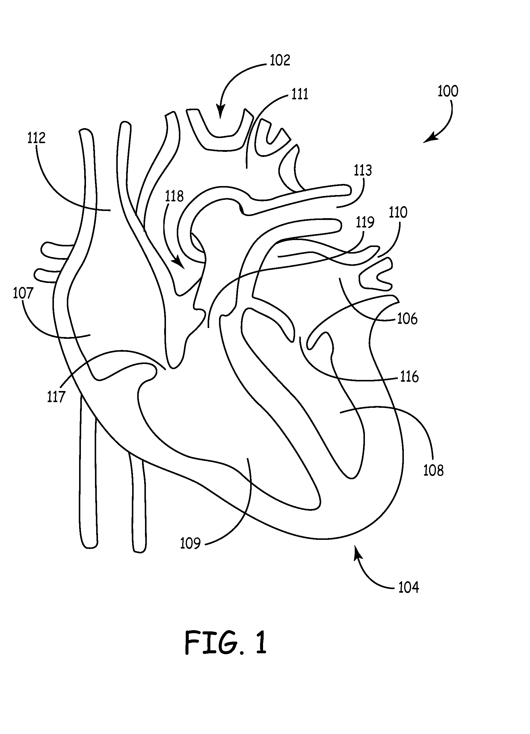 Heart Monitoring Systems, Apparatus and Methods Adapted to Detect Myocardial Ischemia
