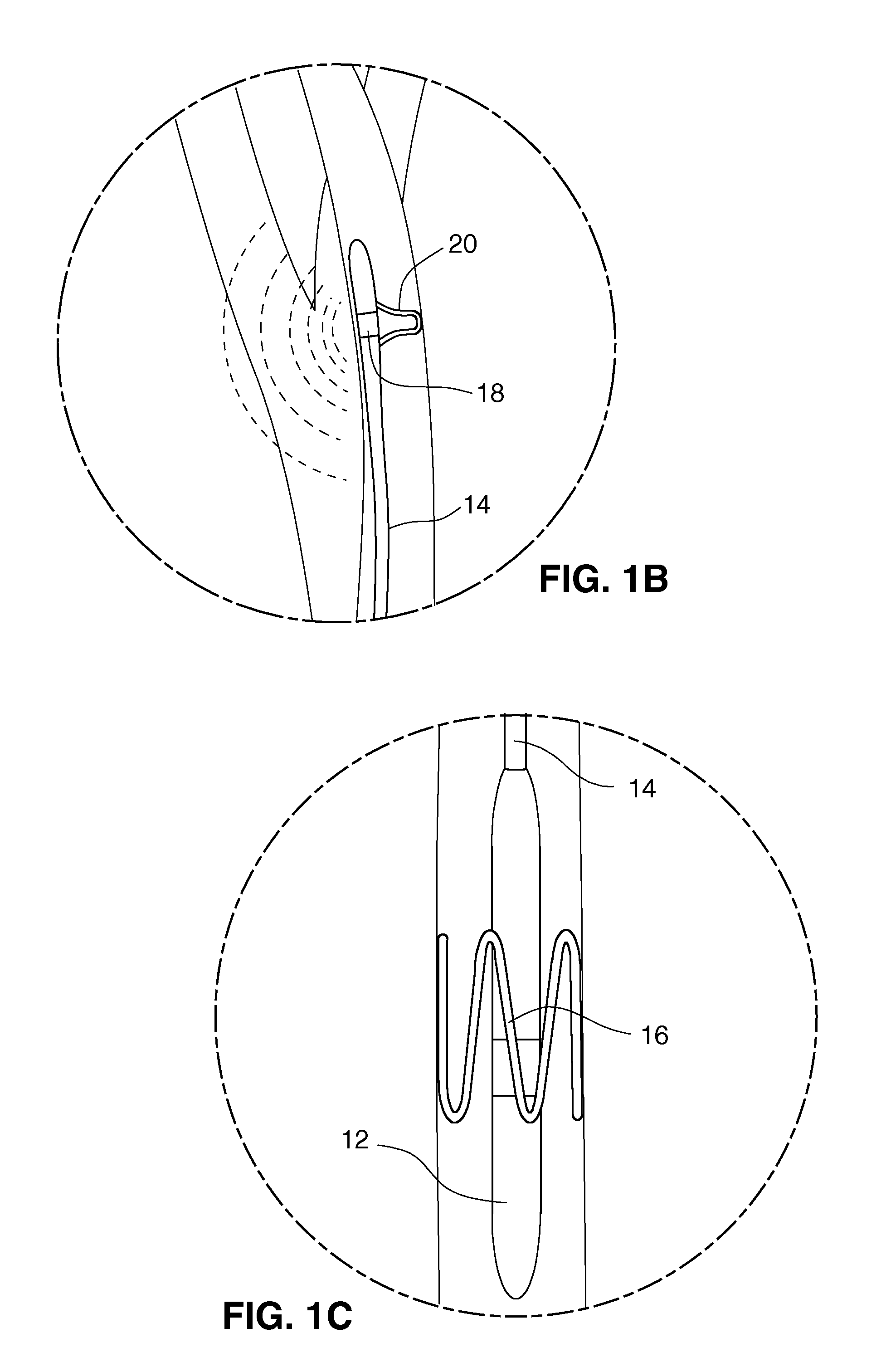 System and method for transvascularly stimulating contents of the carotid sheath