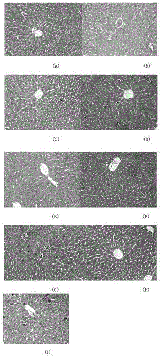 Medicine for resisting acute alcohol-induced hepatic injury and application thereof