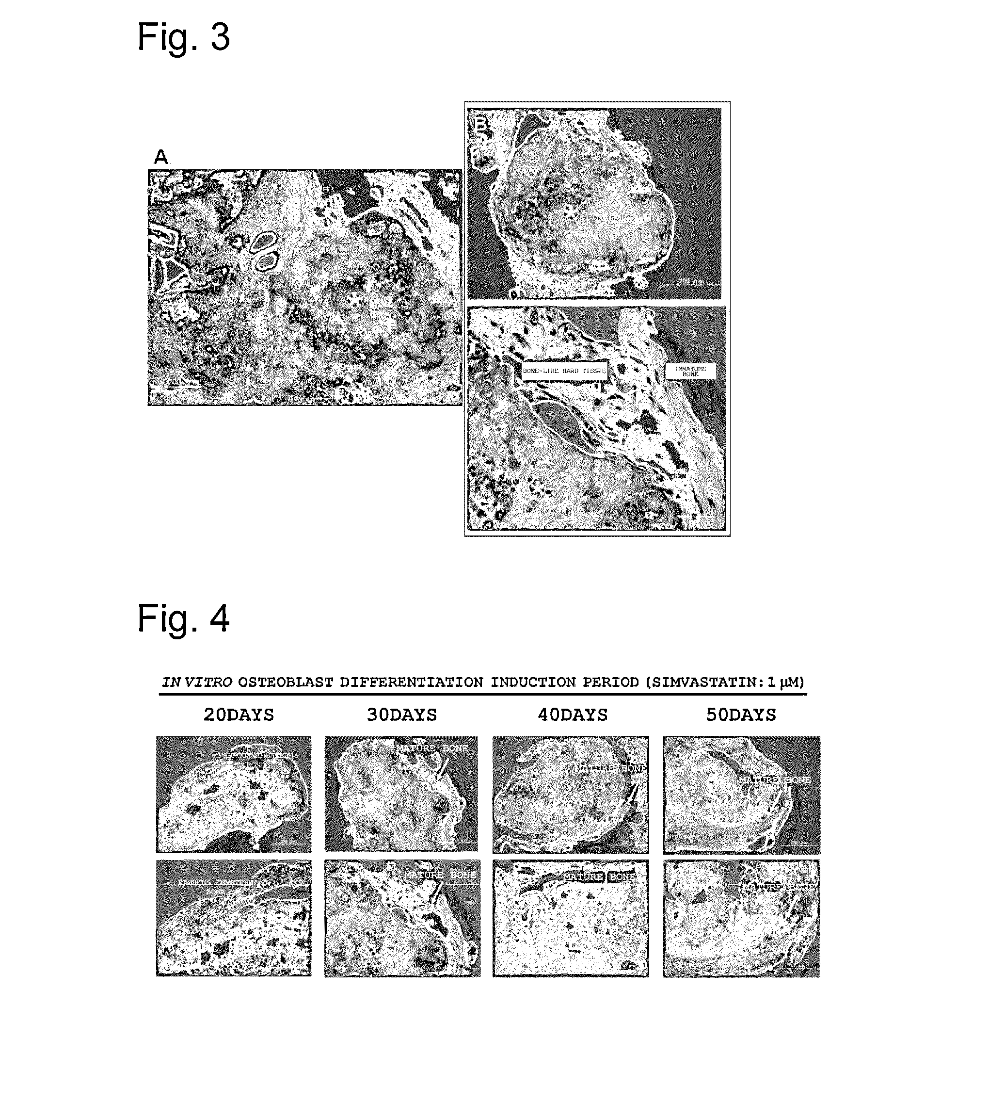 Method for inducing differentiation enabling tumorigenesis of ips cells to be suppressed