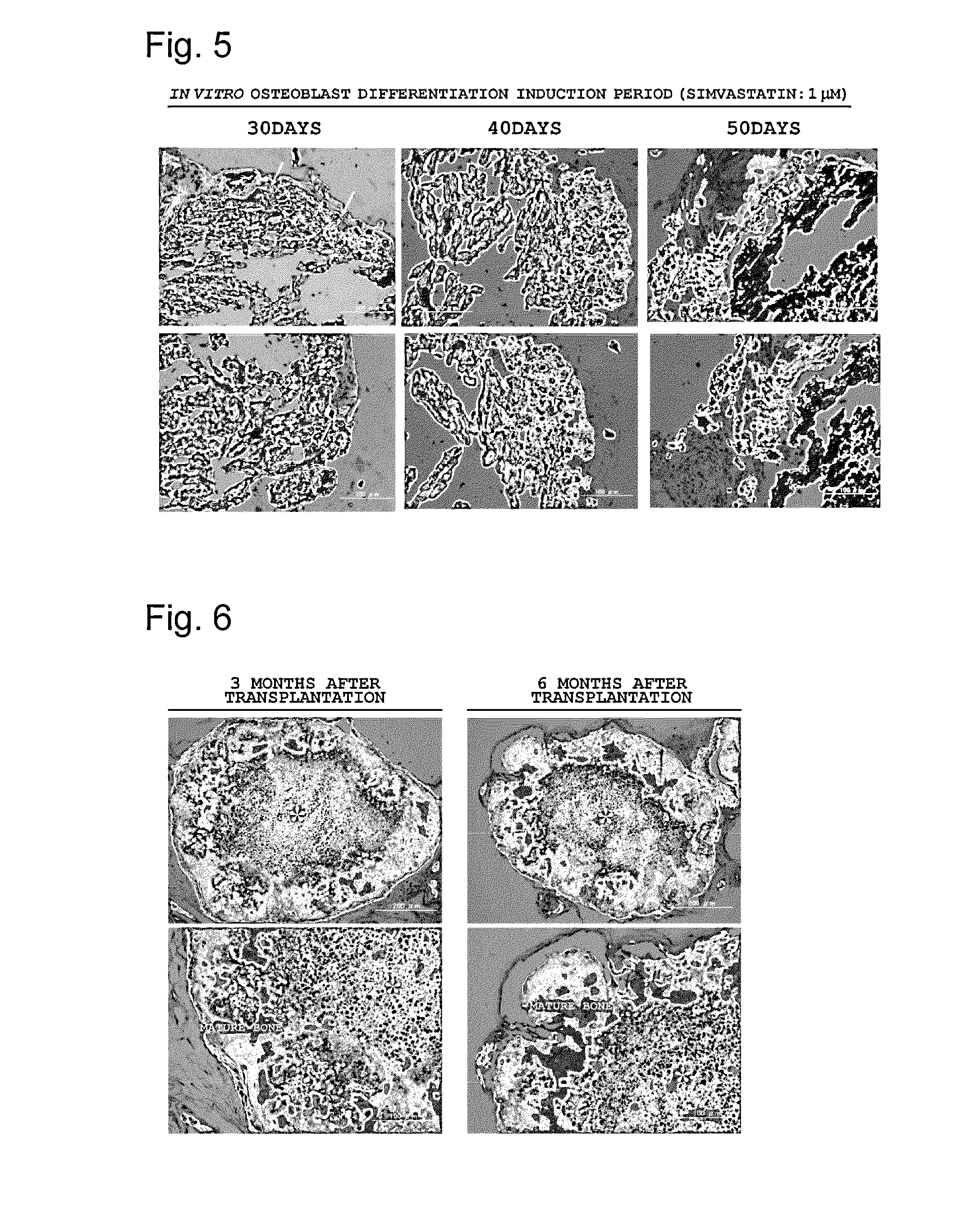 Method for inducing differentiation enabling tumorigenesis of ips cells to be suppressed