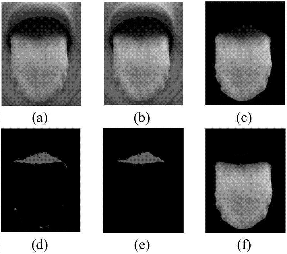 Tongue picture classification method based on multitask convolution neural network