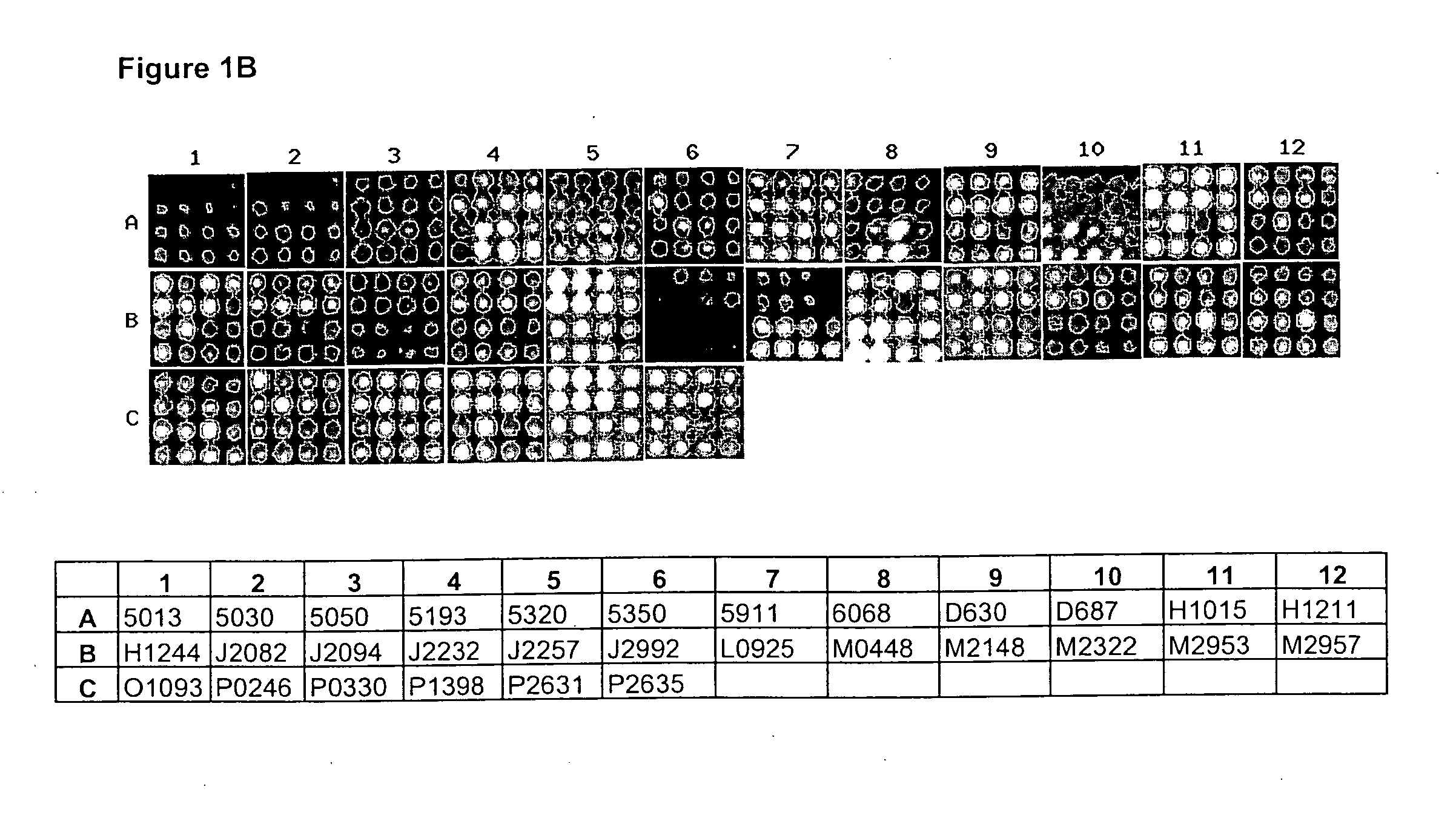 Lung cancer specific gene products: their coding sequence, their antibodies and their use in diagnostic, therapeutic and disease management of lung cancer