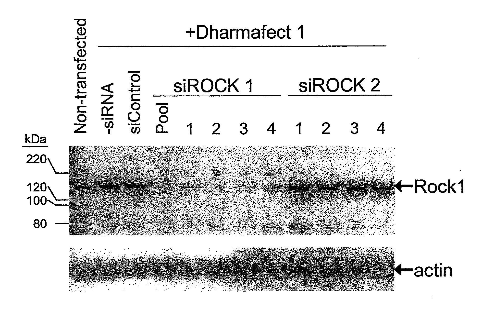 RNAi-Mediated Inhibition of RHO Kinase for Treatment of Ocular Disorders