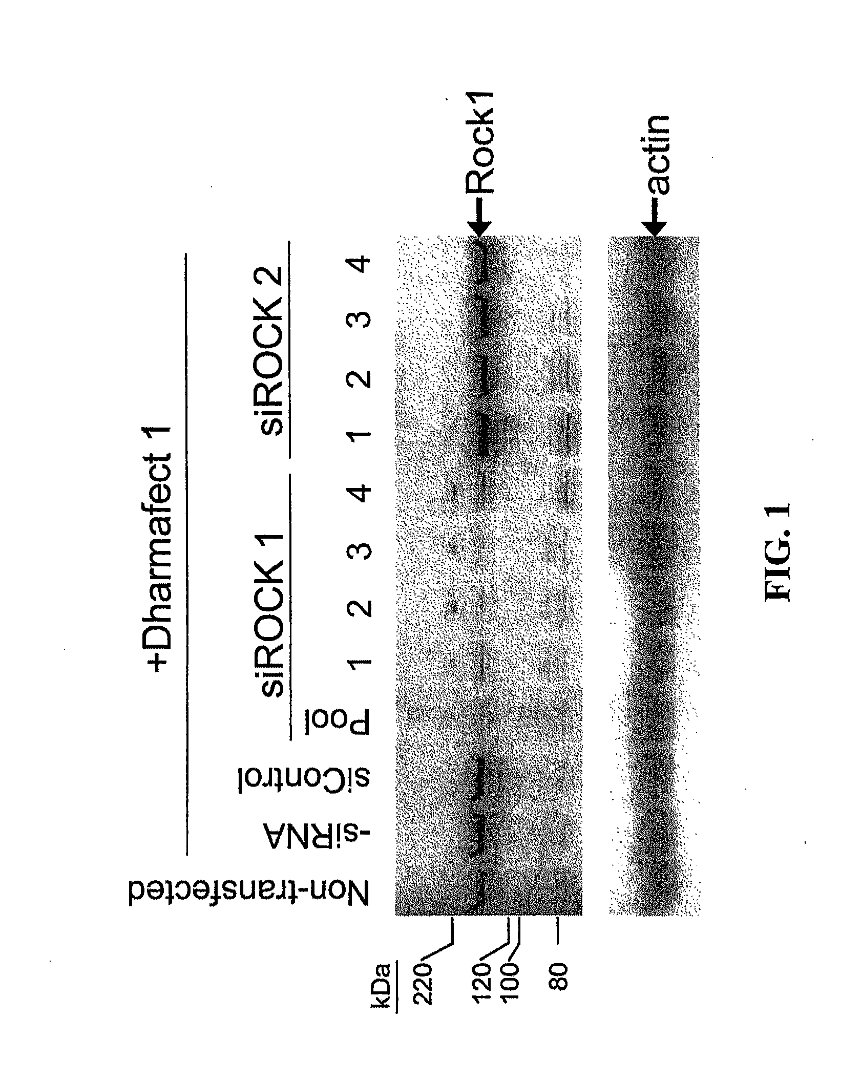 RNAi-Mediated Inhibition of RHO Kinase for Treatment of Ocular Disorders