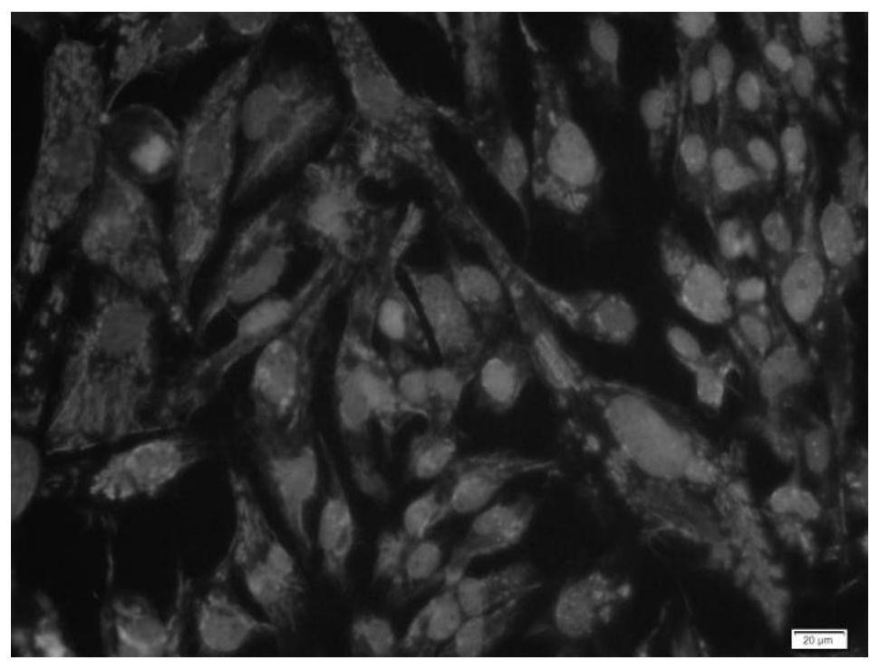 A method for establishing fluorescent nude mouse tumor model based on primary human glioma cells