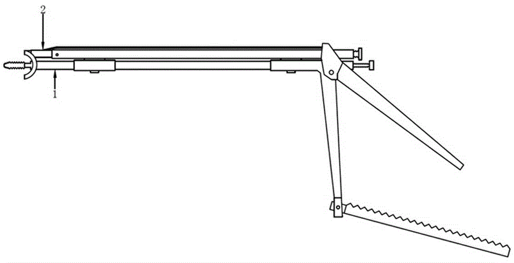 Anterior dislocation reduction fixator for atlantoaxial joint