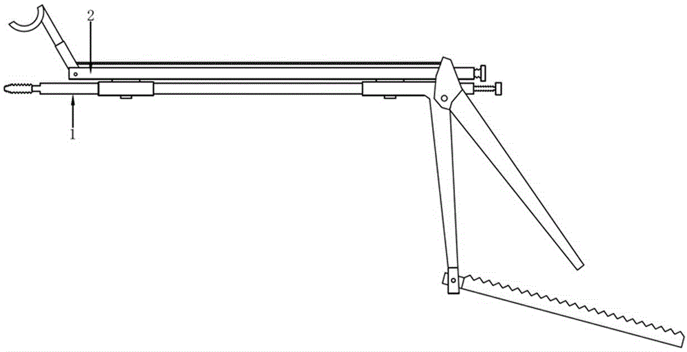 Anterior dislocation reduction fixator for atlantoaxial joint