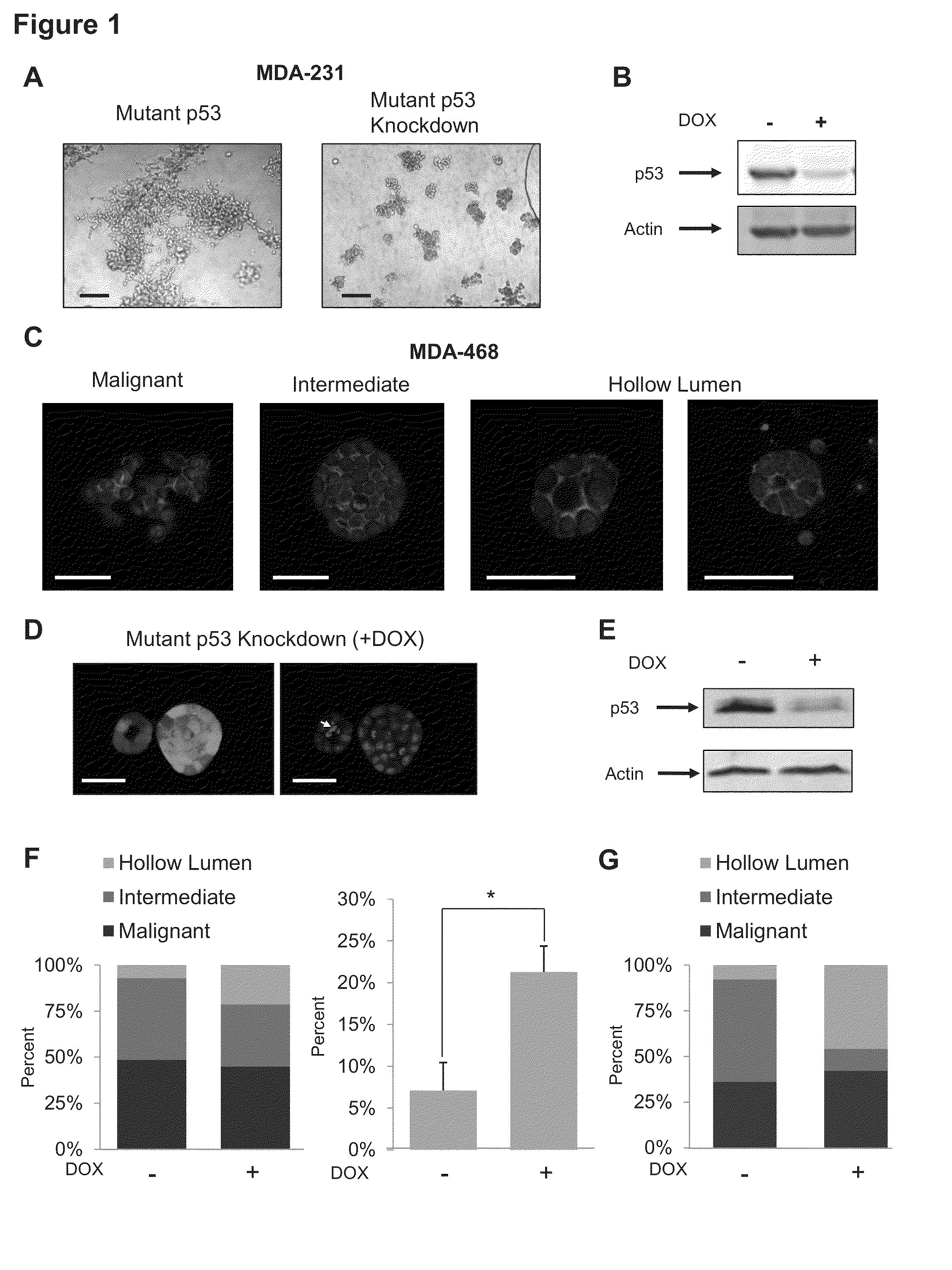 Method for Treating Cancer Harboring a p53 Mutation