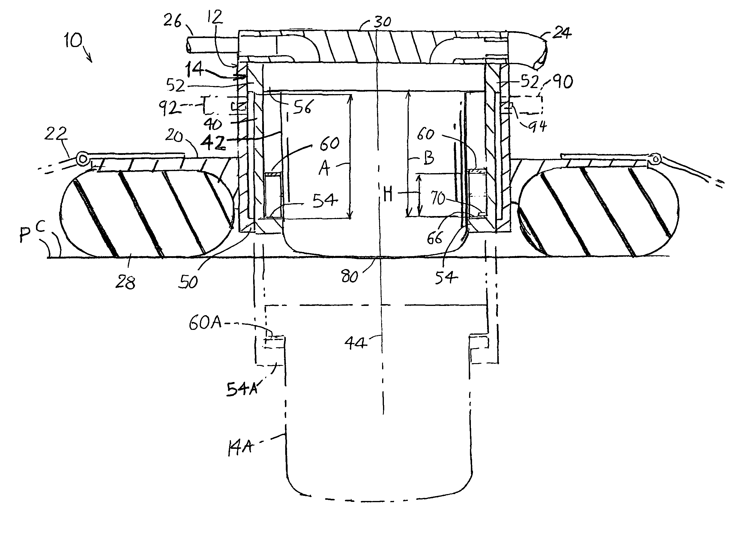 Enhanced chest compressor