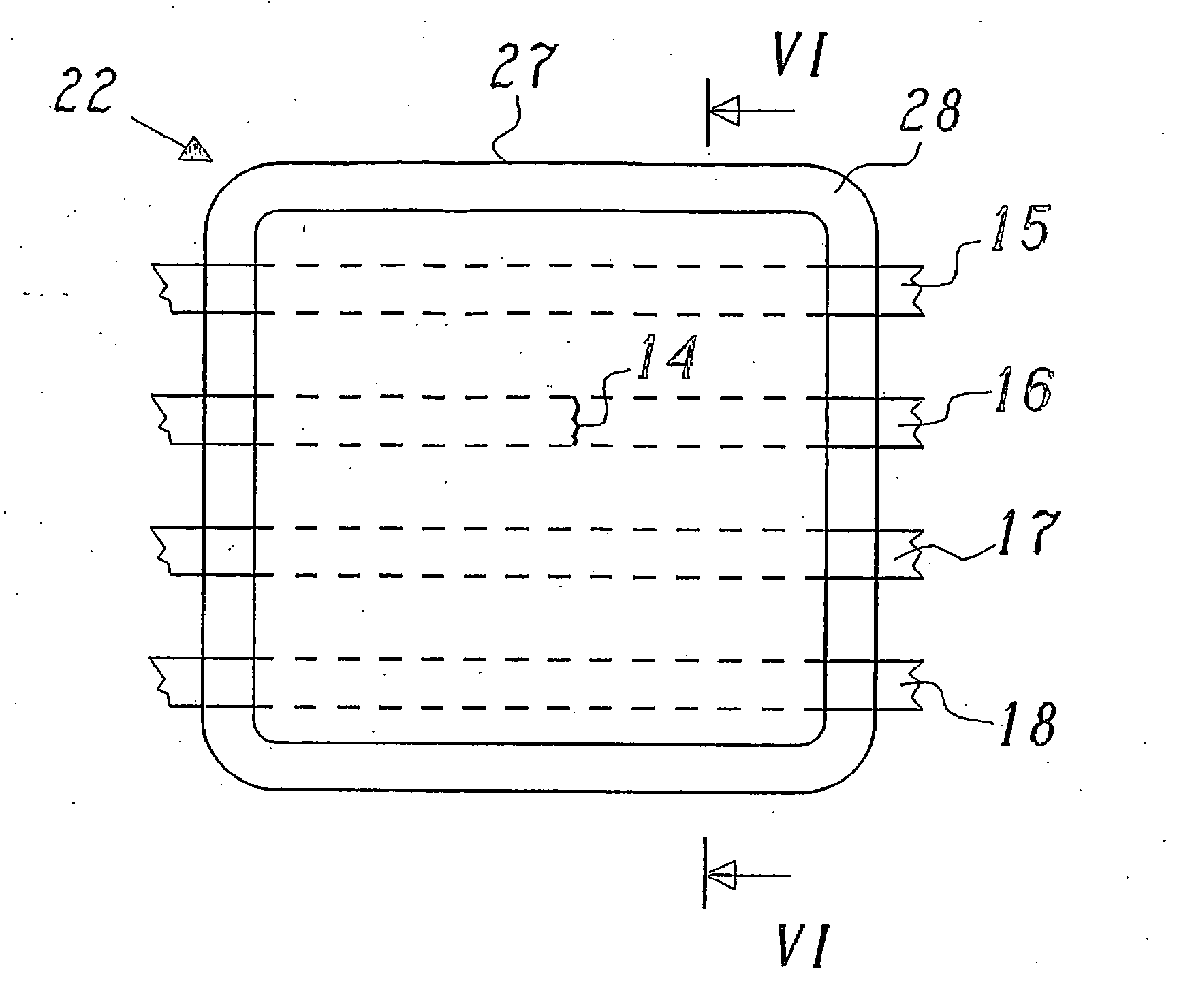 Device and method for analgesic immobilization of fractured ribs