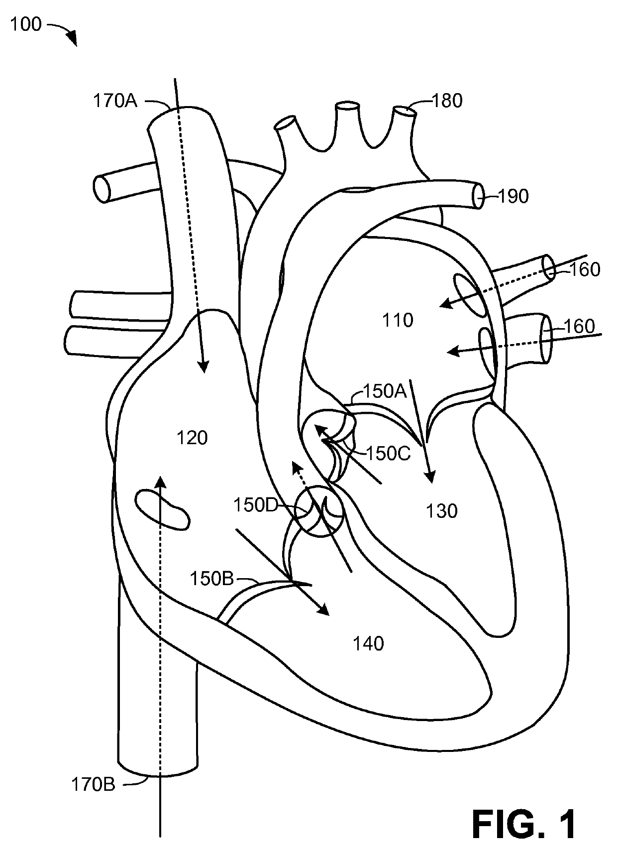 Trileaflet mechanical prosthetic heart valve