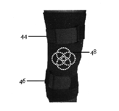 Anatomically configured tubular body of woven or knitted fabric for pressure support of articulating joint