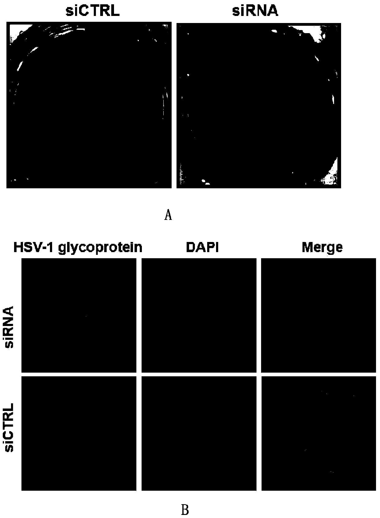 Application of antiviral double-stranded RNA and its temperature-sensitive gel preparation in the treatment and prevention of diseases caused by hsv-1