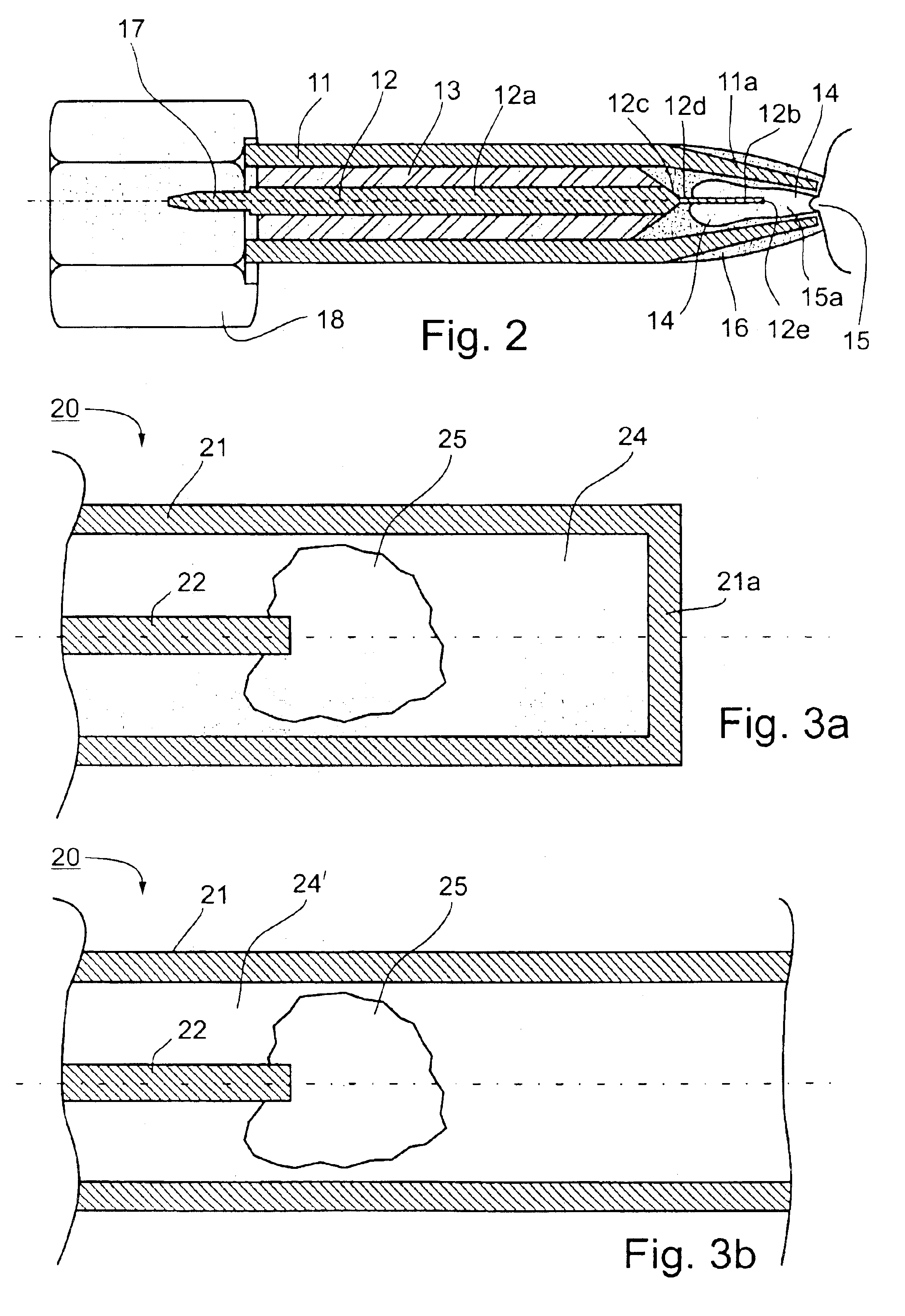Method and system for examining tissue according to the dielectric properties thereof