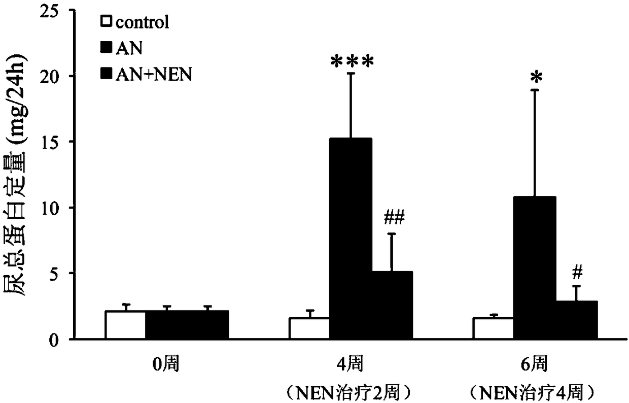 Applications of niclosamide ethanolamine salt and medicinal composition thereof