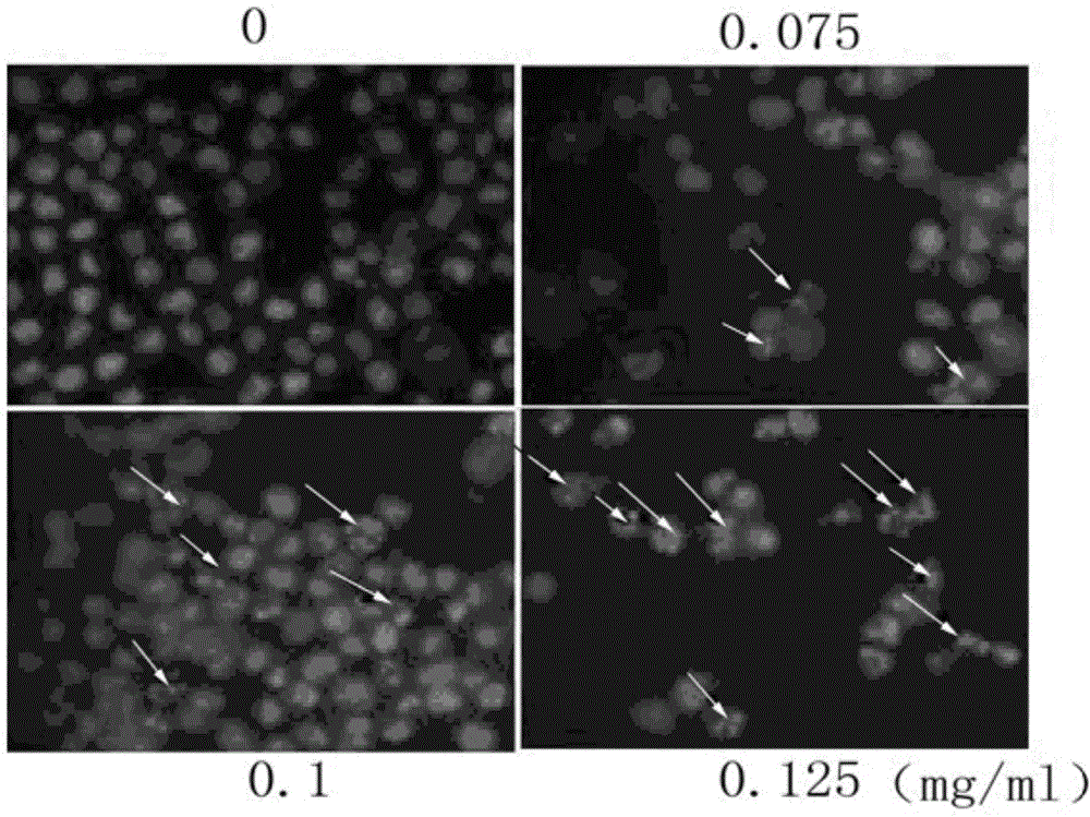 Traditional Chinese medicine composition for treating myelodysplastic syndrome and applications thereof