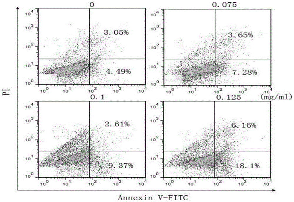 Traditional Chinese medicine composition for treating myelodysplastic syndrome and applications thereof