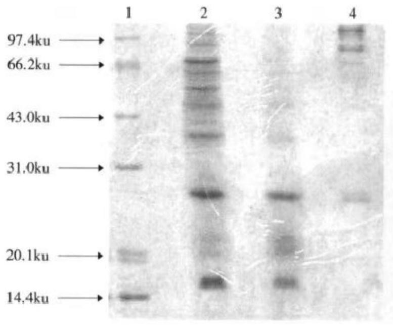 Wound protein sponge, preparation method thereof and application of wound protein sponge in preparation of medicine for reducing scar formation in skin repair